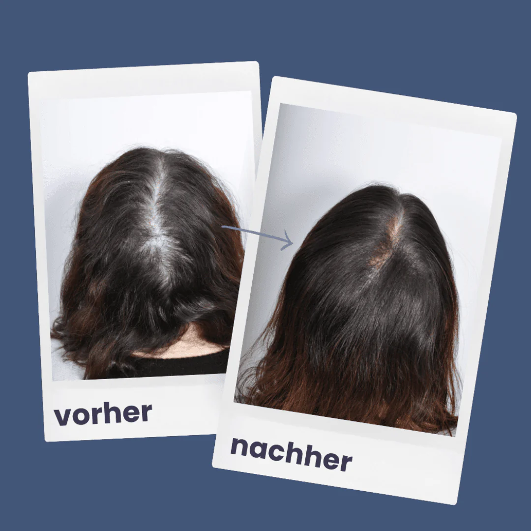 Vorschaubild 6